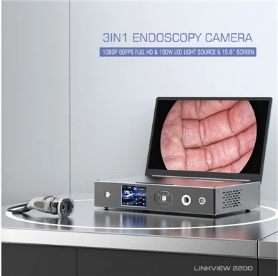 3 hüvelykes -1 2200 hosszú laparoszkópos kamera